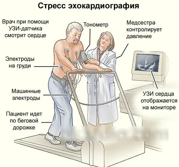 Эхо экг где сделать. Подготовка к стресс эхо экг. стресс эхо кг тредмил тест. стресс эхо-кг сердца проба положительная. стресс-эхокардиография (стресс-эхо кг).