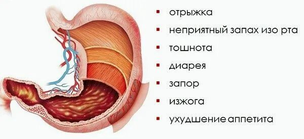 Изо рта причины желудок