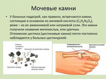 Почечная кислота