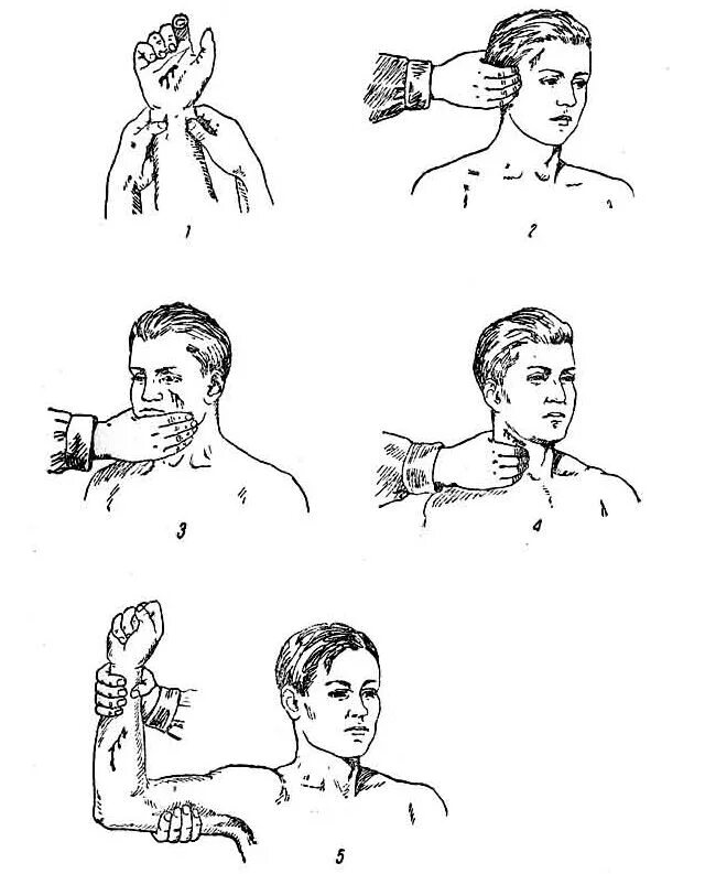 Способы остановки кровотечения пальцевое прижатие артерии. Остановка артериального кровотечения пальцевое прижатие артерий. Пальцевое прижатие артерий при кровотечениях алгоритм. Остановка кровотечения методом пальцевого прижатия. Рис. 1. пальцевое прижатие артерии при кровотечении.