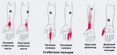 Почему болит левая ладонь