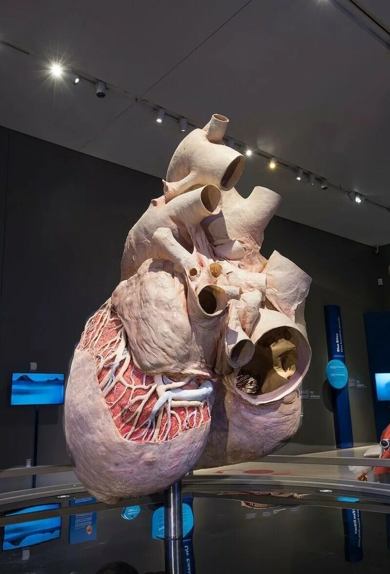 Сердце кита весит. Сердце кита весит. Сердце кита весит. Самое большое сердце кита. Размер сердца синего кита.