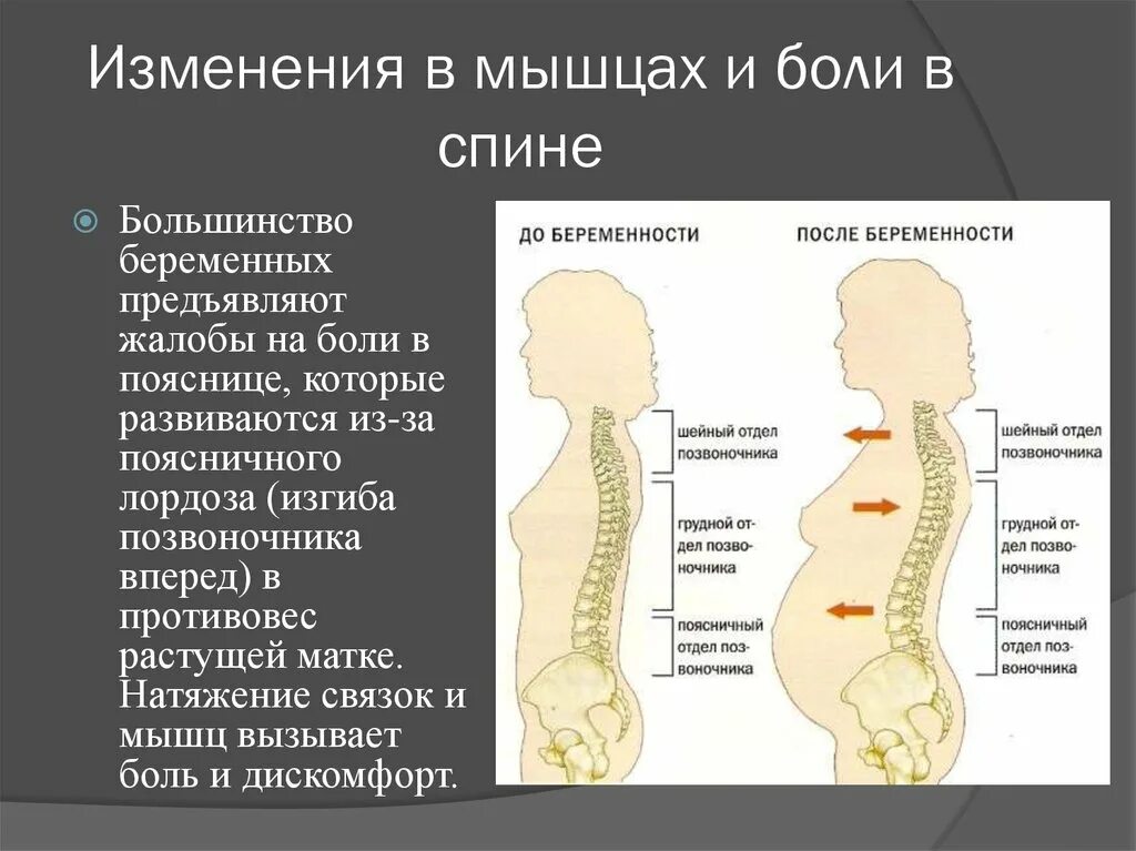 Позвоночник у беременных. Изменения позвоночника у беременных. Изменение позвоночника при беременности. Лордоз.