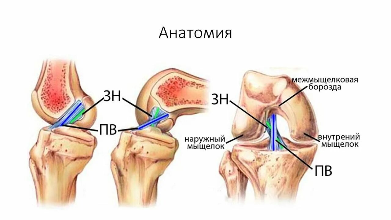 Передняя крестообразная связка коленного сустава анатомия. Межмыщелковая борозда коленного сустава. Крестообразная связка колена. Передне крестообразная связка. Симптомы крестообразной связки коленного сустава