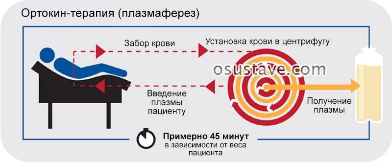 Гемофорез что это. Плазмаферез принцип действия. Плазмаферез схема. Схема проведения плазмафереза. Плазмаферез схема проведения.