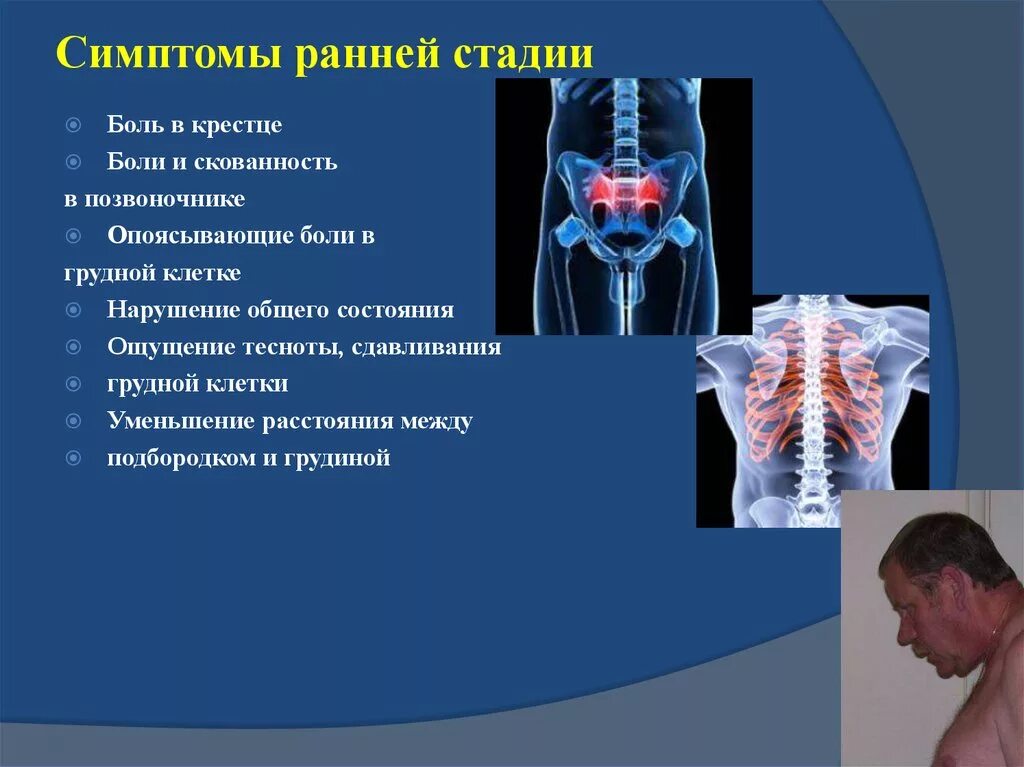 Сильно сжали грудную клетку. Ощущение сдавленности в грудной. Ощущение сдавливания в грудной клетке.