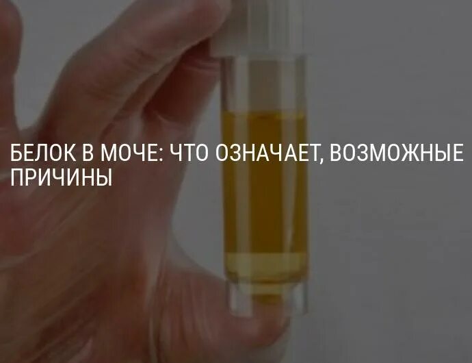 Белок в моче болезни. Из за чего появляются белки в моче. Из за чего появляются белки в моче. 1 что это значит. Норма белка в моче у детей 2 года.
