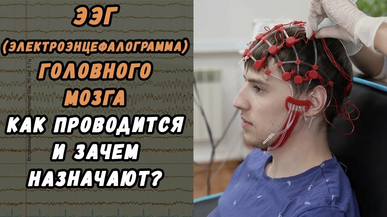 Ээг хабаровск. ЭЭГ В Хабаровске ребенку. ЭЭГ Аист Хабаровск. ЭЭГ видеомониторинг детское. ЭЭГ во сне Хабаровск.