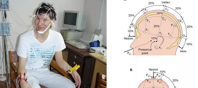 Проверить головной мозг как называется процедура