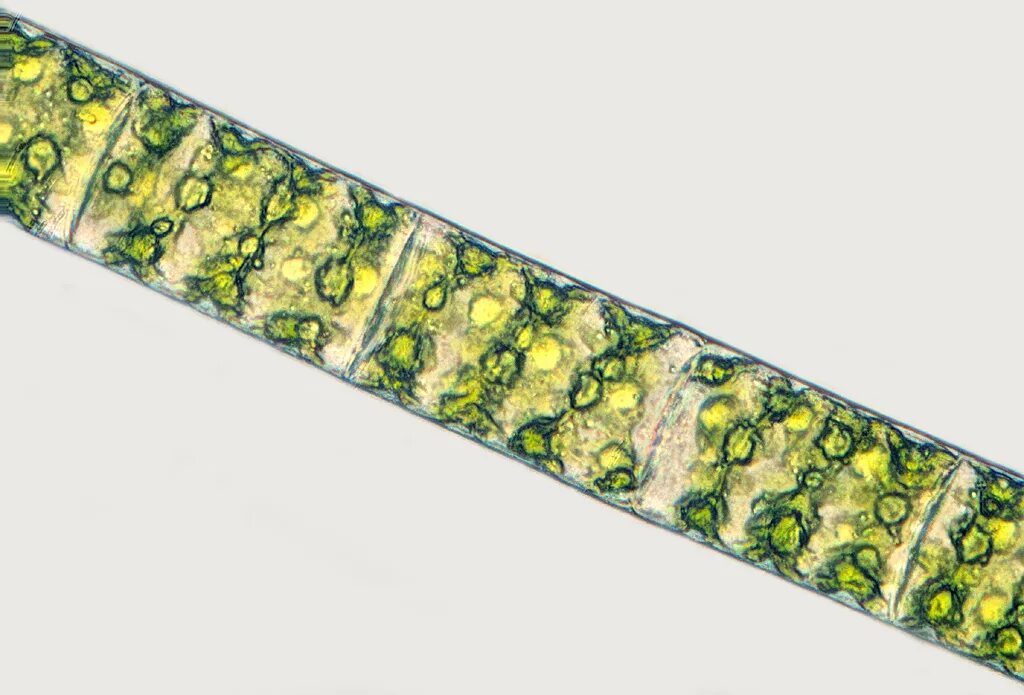 Спирогира многоклеточная. Spirogyra водоросль. Спирогира спирогира. Спирогира микропрепарат. Водоросль спирогира под микроскопом.