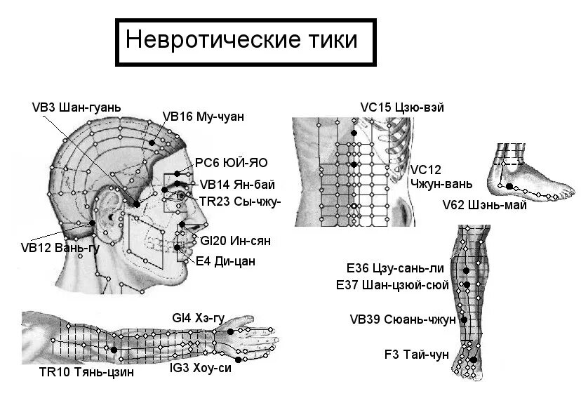 Ru publ 1. Акупунктура при ДЦП точки. Биологически активные точки - точки акупунктуры. Акупунктура схема. Рефлексотерапия схема точек воздействия.