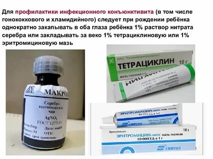 Профилактика конъюнктивита