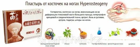 Лечение косточки без операции