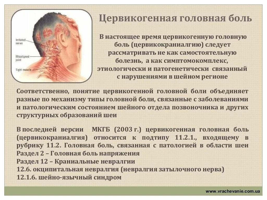 Болезнь напряжения мышц