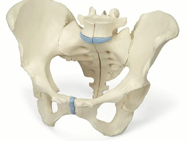 Правая лонная кость. Перелом позвонка крестца. Вертикальный перелом крестца. Таз человека.