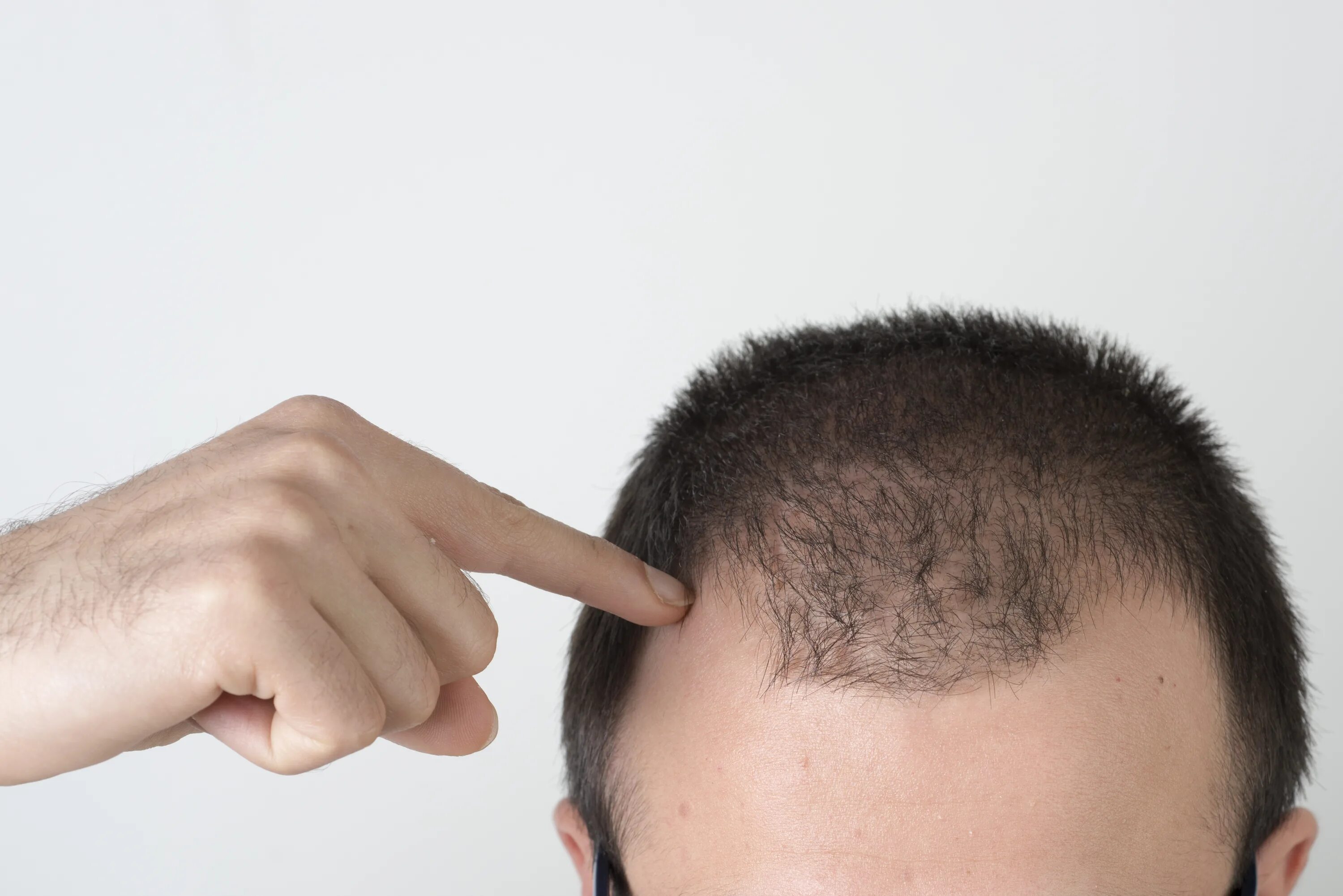 It can hair. It can hair. It can hair. Сухие волосы. It can hair.