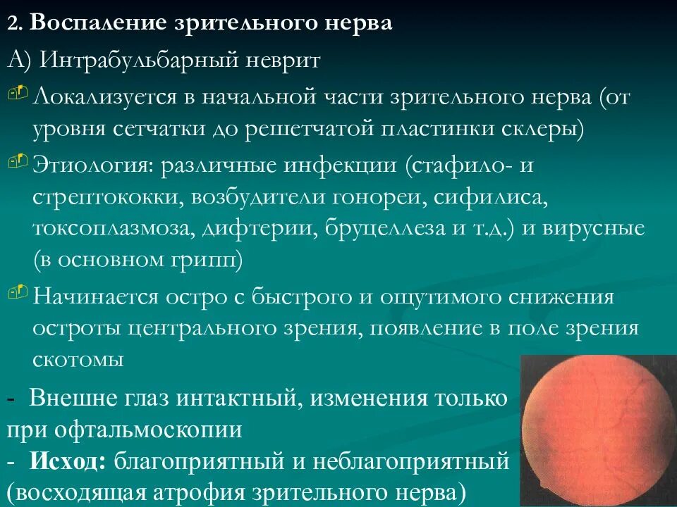 Почему воспаляется нерв. Интрабульбарный неврит зрительного нерва. Неврит зрительного нерва интрабульбарный папиллит. Воспален е зрительнного нерраа. Исход неврита зрительного нерва..