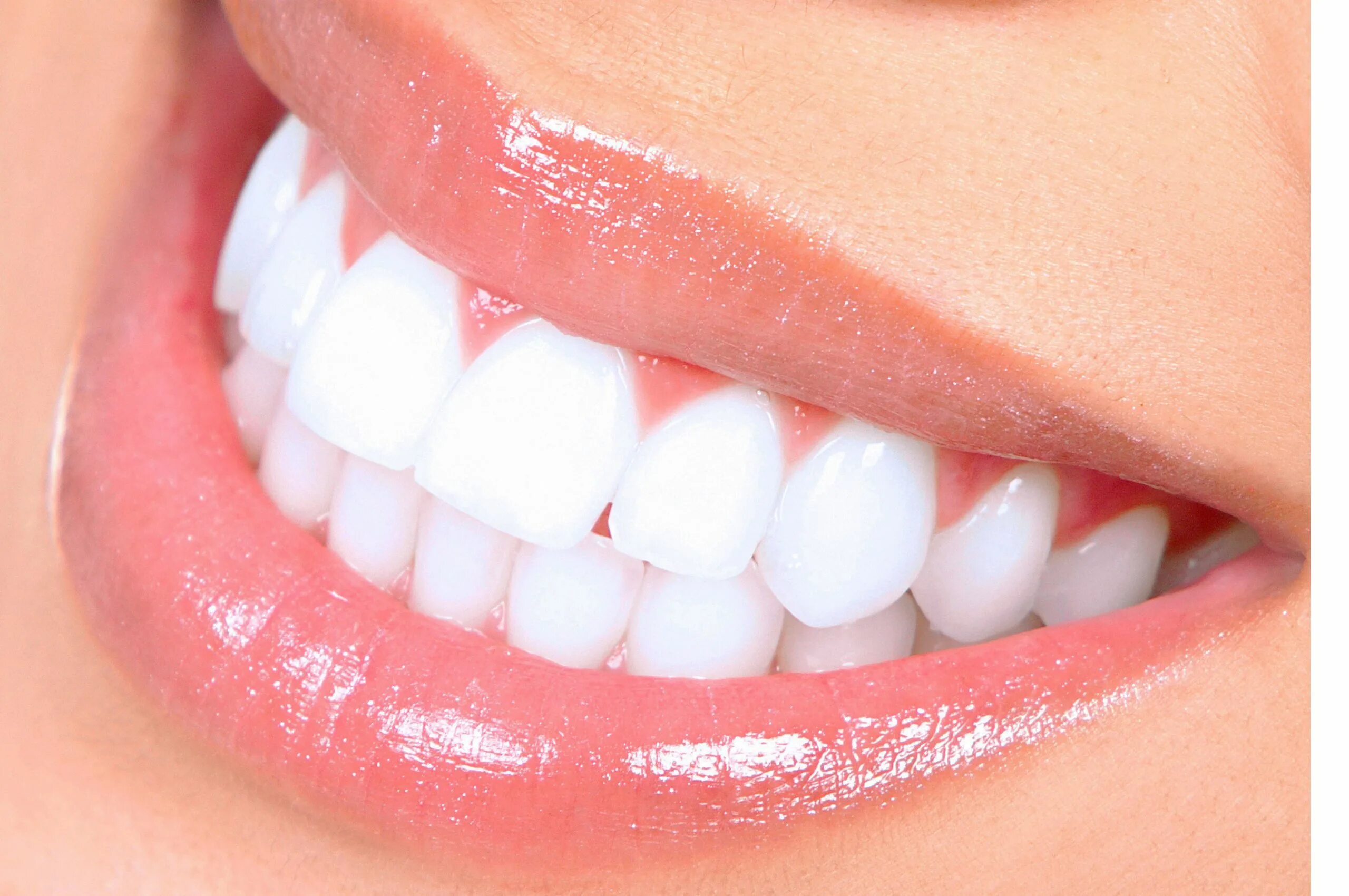 Ровные зубы. Голливудская улыбка виниры. Идеальные зубы. Красивые зубы. Красивые ровные зубы.