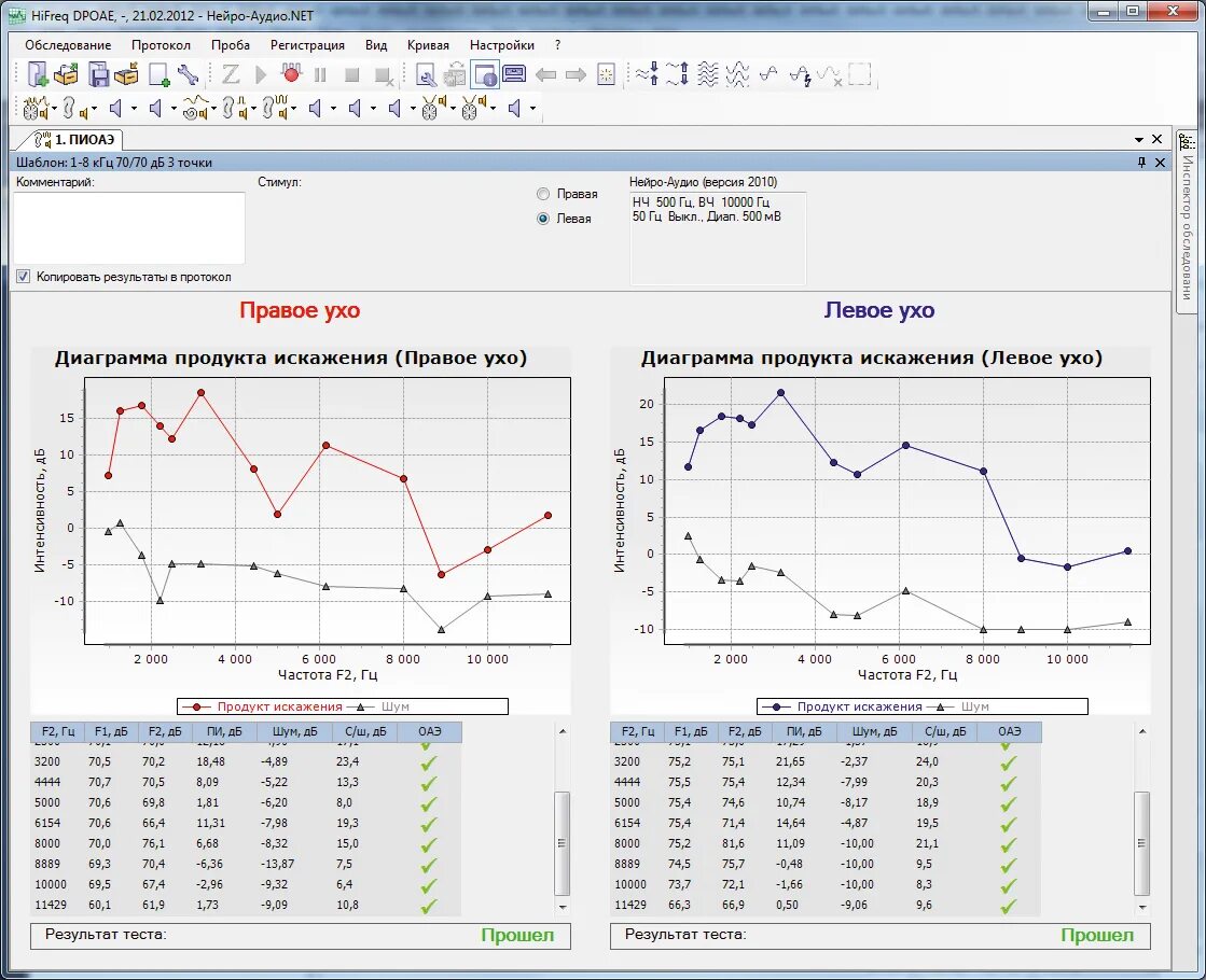 Диаграмма ПИОАЭ. Диаграмма ПИОАЭ слуха. ПИОАЭ. Тест ЗВОАЭ Результаты. Нейро тесты