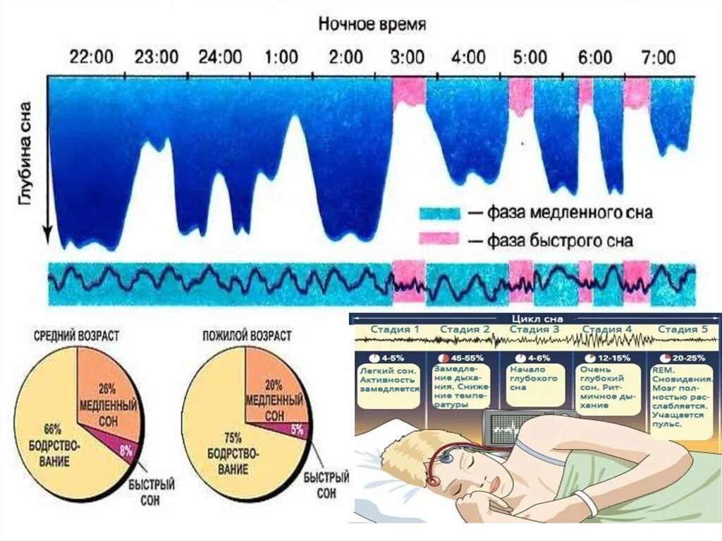 Сон человека медленный и быстрый. Фазы сна. Сон фазы сна. Фазы сна таблица. Стадии фазы медленного сна.