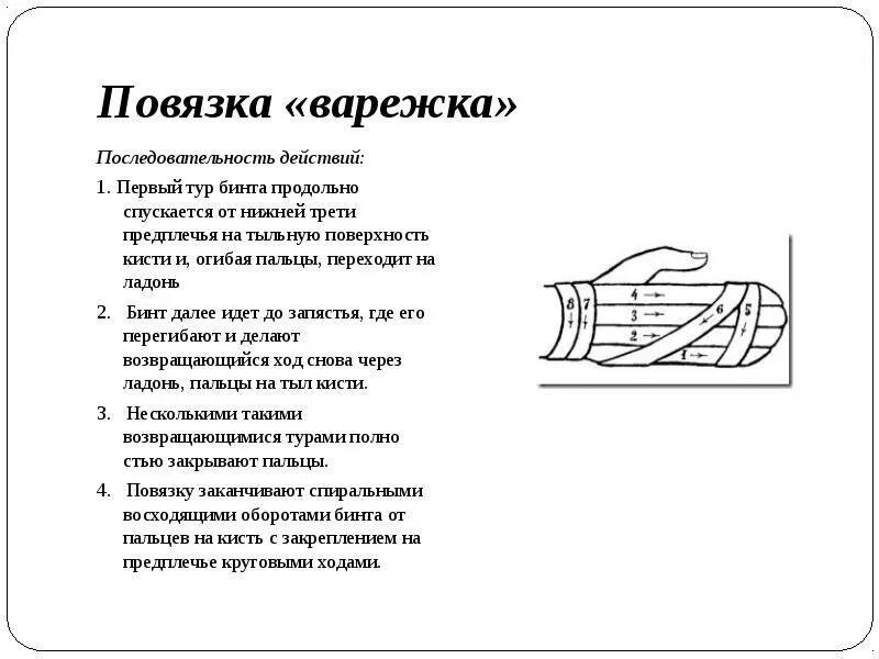 Повязка на кисть алгоритм. Наложение повязки варежка. Наложение повязки варежка алгоритм. Техника наложения повязки варежка. Повязка варежка на кисть алгоритм.