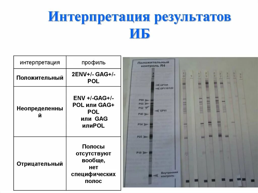 Иммуноблоттинг интерпретация результатов. Иммуноблот ВИЧ. ИФА И иммуноблоттинг. . Иммуноблот для диагностики ВИЧ-инфекции..