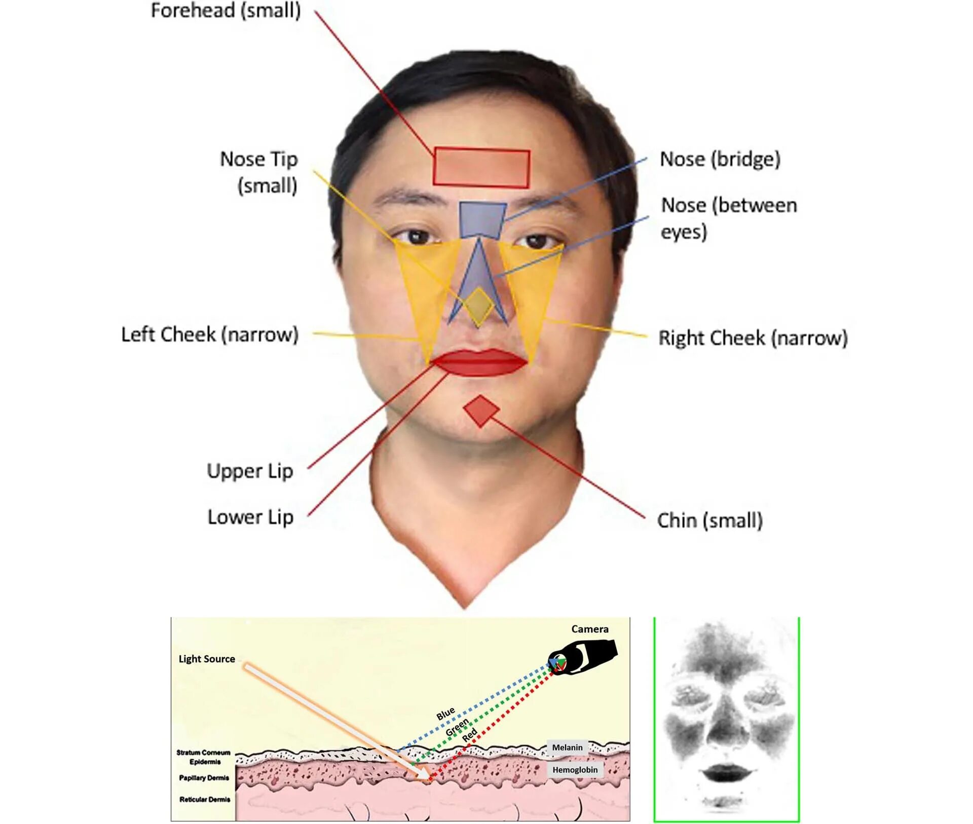 Small forehead. Narrow forehead. Domed forehead. Region of the face.