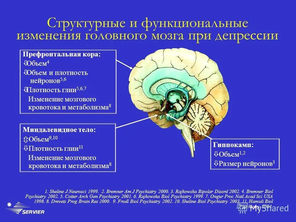 Как происходит головного мозга. Изменения в мозге при депрессии. головной мозг при депрессии. структурные изменения головного мозга. функциональные изменения мозга.