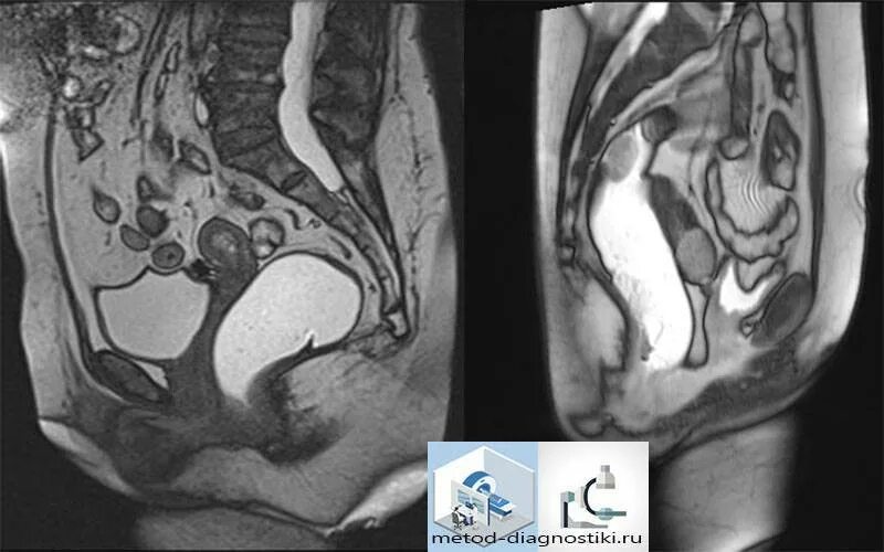 Мрт женских органов. Мрт малого таза у женщин. Мрт малый таз. Мрт малый таз. Мрт женских органов.