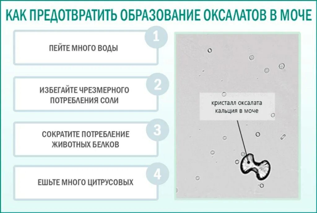 Кристаллы оксалата в моче у мужчин. Оксалаты в моче. Повышенные оксалаты в моче. Кристаллы кальция в моче. Соли в моче.