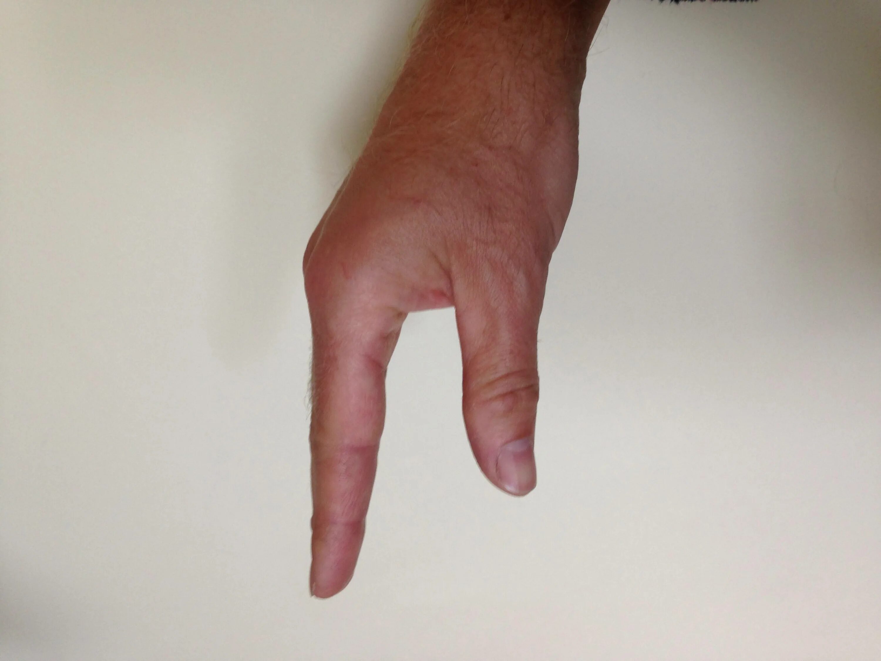 Почему палец назвали палец. Между фалангами большого и указательного пальцев.. Три фаланги на большом пальце. Изогнутый большой палец признак.