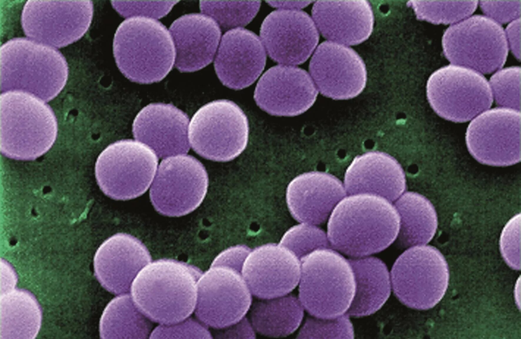 Staphylococcus aureus 4
