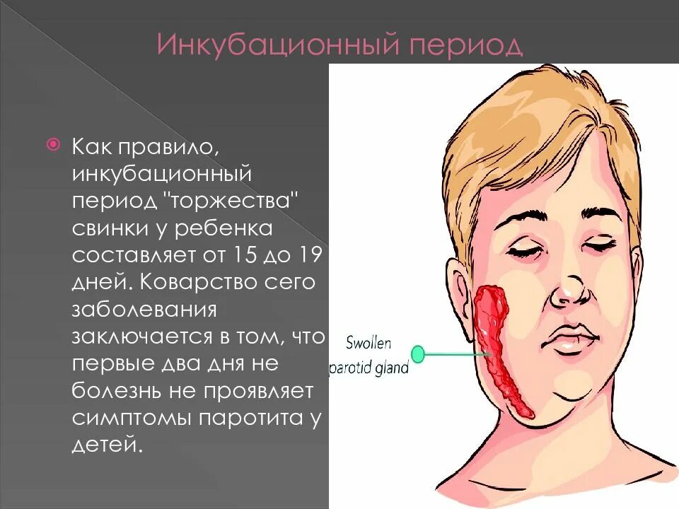 Больной свинкой. Инкубационный период свинки. Свинка болезнь симптомы у детей.