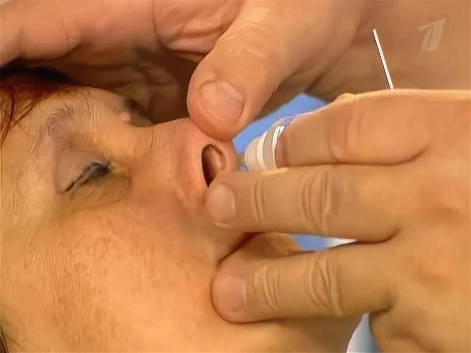 Уход за глазами ушами. Закапывание капель в нос. Обработка носовой полости пациента. Закапывание носа пациенту. Закапывание капель в нос и уши.