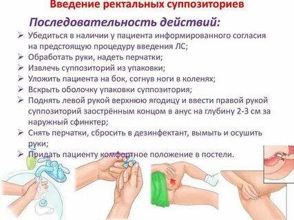 Как правильно вставить свечу женщине