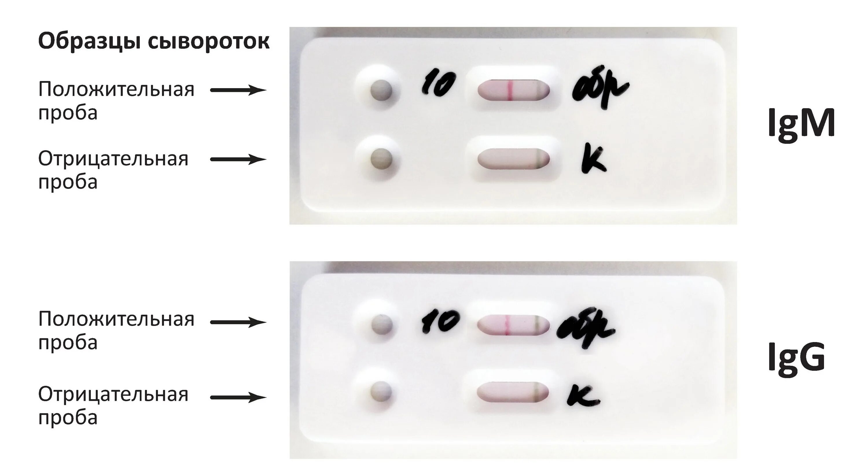 Антиген коронавирус sars cov 2. Экспресс тест на коронавирус одна полоска. Положительный тест на коронавирус полоски. Экспресс тест на коронавируса 2 полоски. Тест полоски на коронавирус.