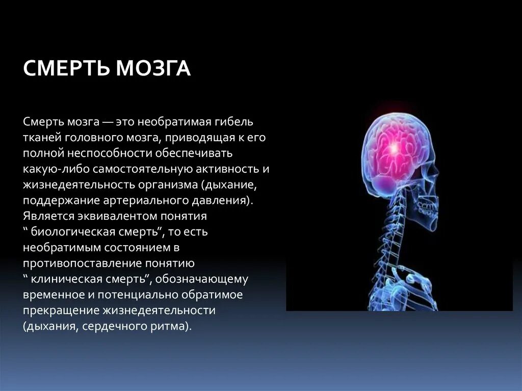 Признак жизни головного мозга. Смерть мозга. Клиническая смерть мозга. Критерии смерти головного мозга.