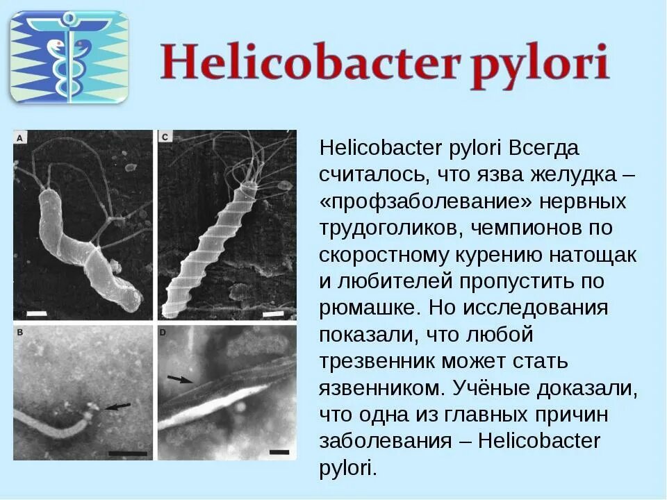 Язва желудка хеликобактер. Язва 12 перстной кишки вызванная хеликобактер пилори. Заболевание, вызываемое хеликобактер пилори. Инфицированность Helicobacter pylori.
