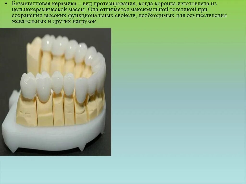 Почему не изготавливают цельнокерамических подошв. Виниры безметалловая керамика. Безметалловая керамика - цельнокерамический винир / коронка / вкладка. Безметалловая керамика презентация. Протокол фиксации безметалловой керамики e-Max.