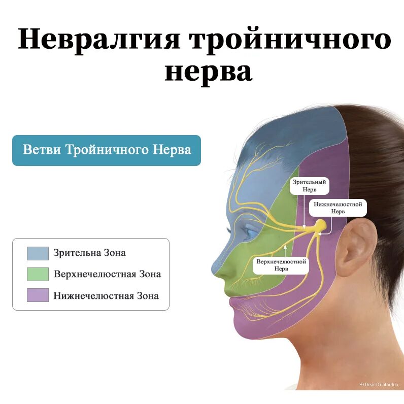 Неврология 3 ветви тройничного нерва. Лицевая ветвь тройничного нерва. Невралгия тройничного нерва синдромы. Клинические симптомы невралгии 2 ветви тройничного нерва. Невропатия затылочного