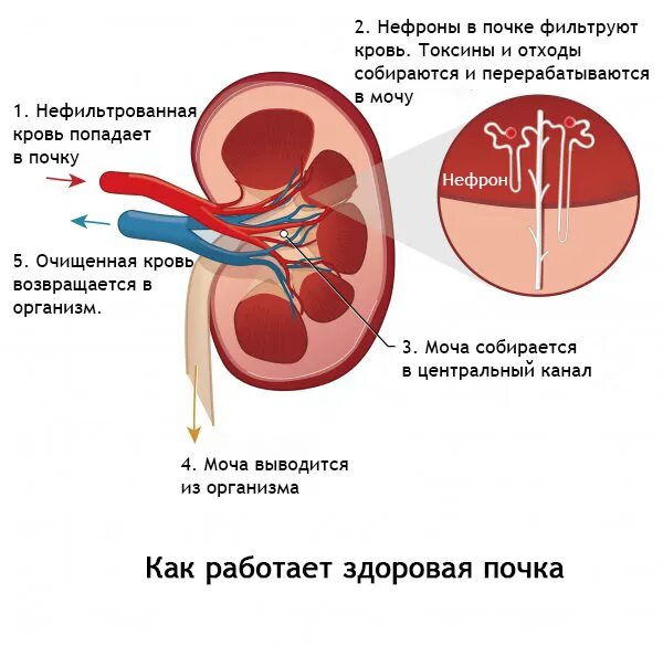 Сколько дают за почку. Почечная недостаточность нефроны. Почка при почечной недостаточности.