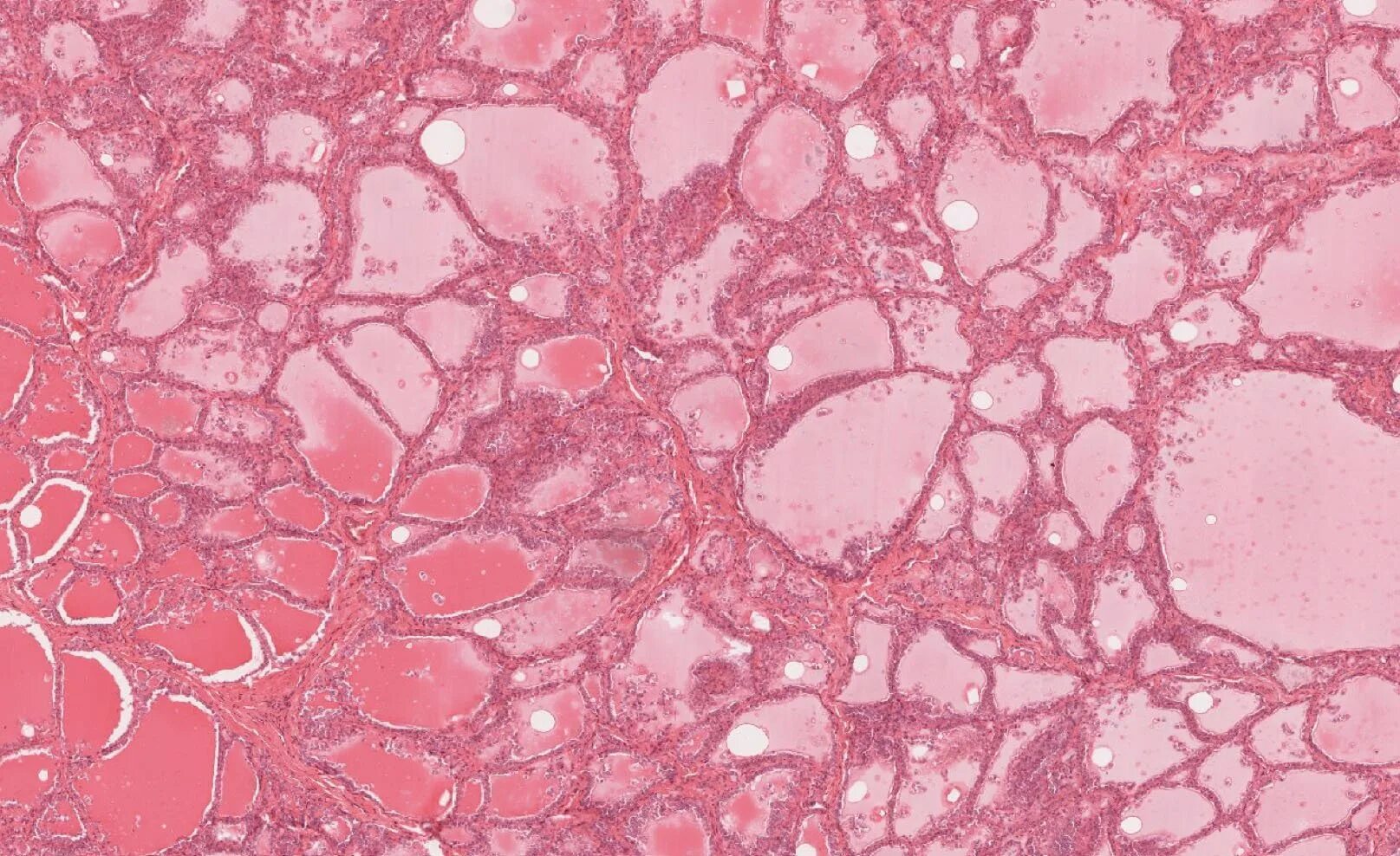 Щитовидная железа гистология препарат. Эндокринная клетка гистология. Паращитовидная железа гистология. Околощитовидная железа гистология.