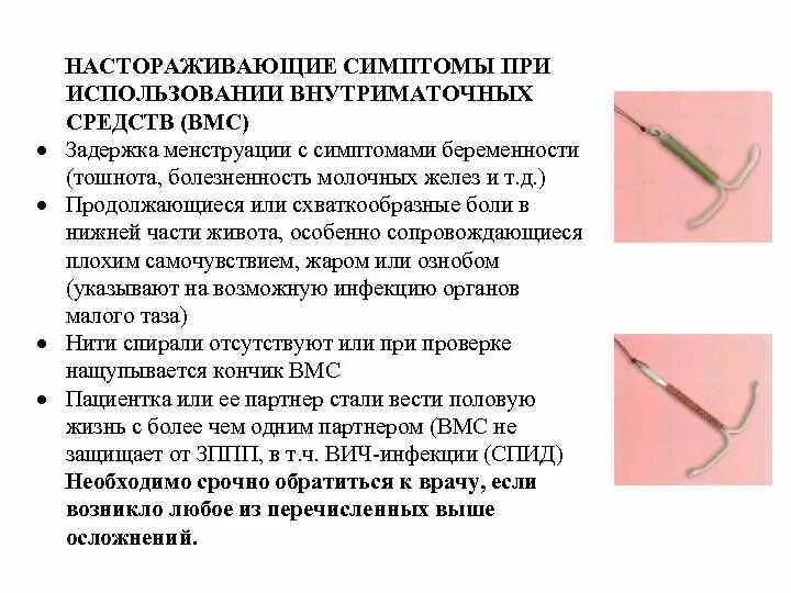Как вытаскивают спираль. Спираль внутриматочная. вмс гормональная. внутриматочные средства (спирали);. инертная внутриматочная спираль.