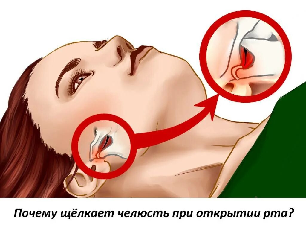 Почему нельзя сводить. Синдром Костена, дисфункция нижнечелюстного сустава.