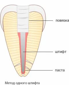 Пломбированный штифт