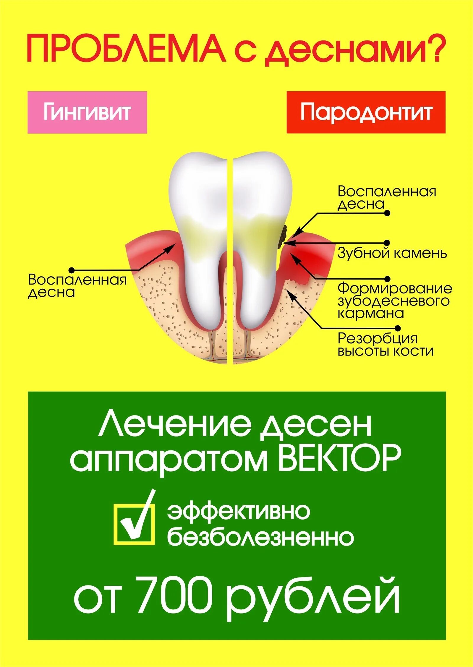 Лечение десен домашними средствами