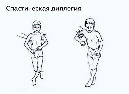 Выделите формы дцп