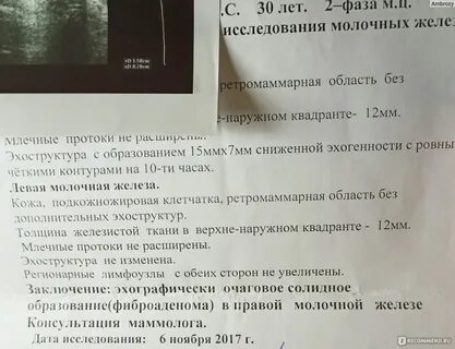 Фиброаденоматоз отзывы