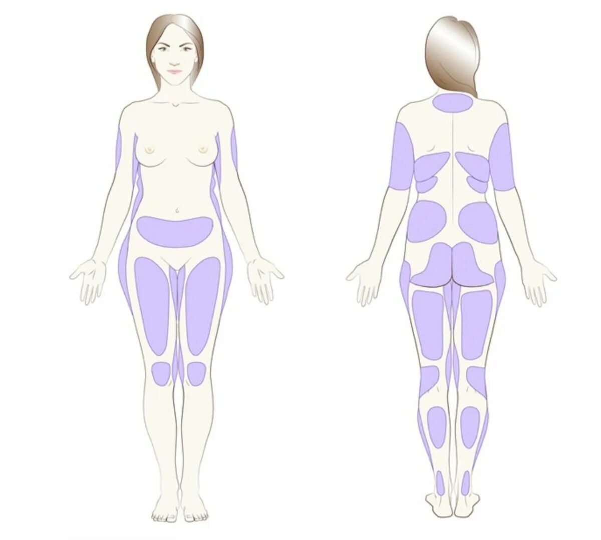 Зоны липосакции на теле схема. Зоны воздействия при кавитации. Зоны для липосакции у женщин. Зоны тела для липосакции.