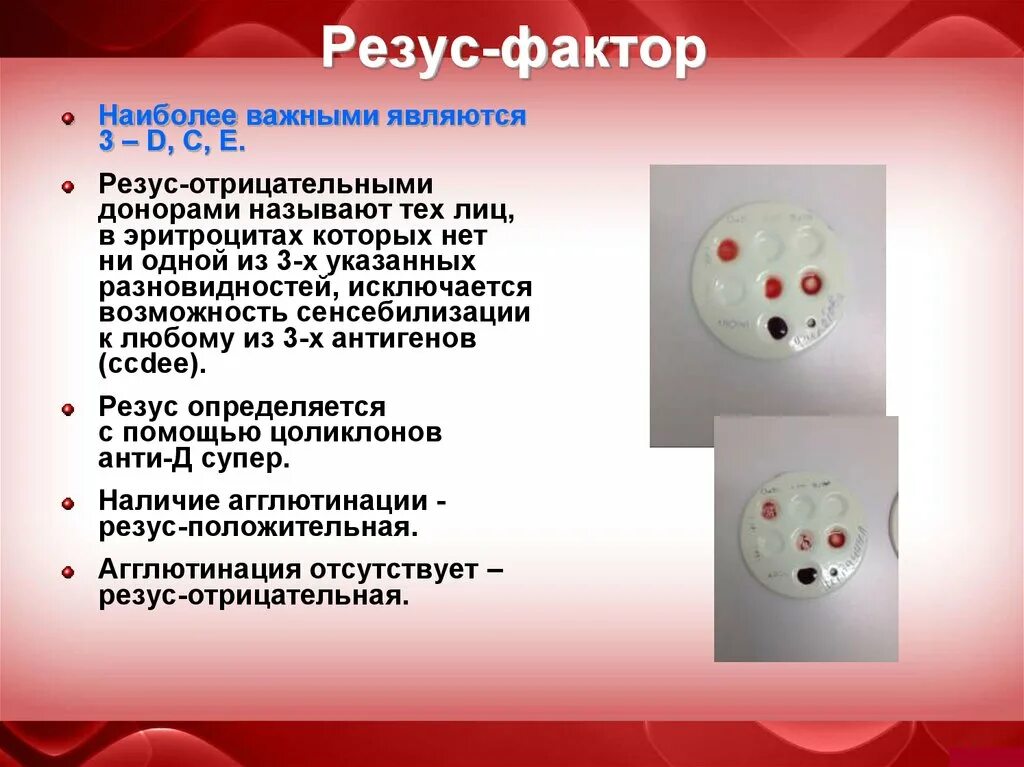 Меняется ли резус крови в течении жизни. Д weak резус фактор. Отрицательный или положительный резус фактор. Резус-фактор крови отрицательный. Положительный и отрицательный резус.